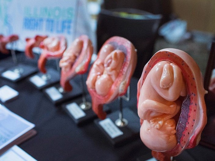 Aborto - um dos maiores holocaustos de sempre da humanidade aborto