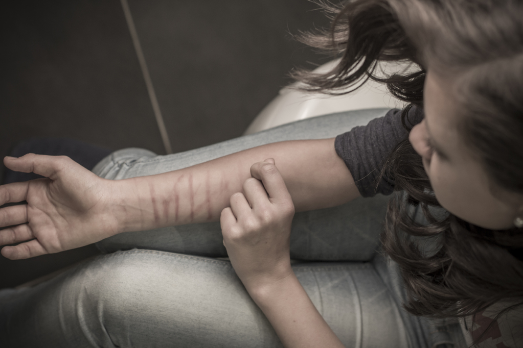 automutilation femme bras full 13058603
